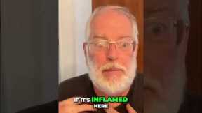 Sleep is KEY: Why You MUST Sleep for Health & Avoid Inflammation! #shorts