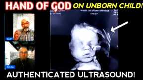 Mother prays repeatedly to God for her unborn child: Lord, please keep Your Hand on my baby!