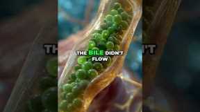 Yellow Poop? Is Your Liver On Strike? Find Out! #shorts