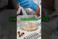 Could Cancer Be Linked to Fungus or